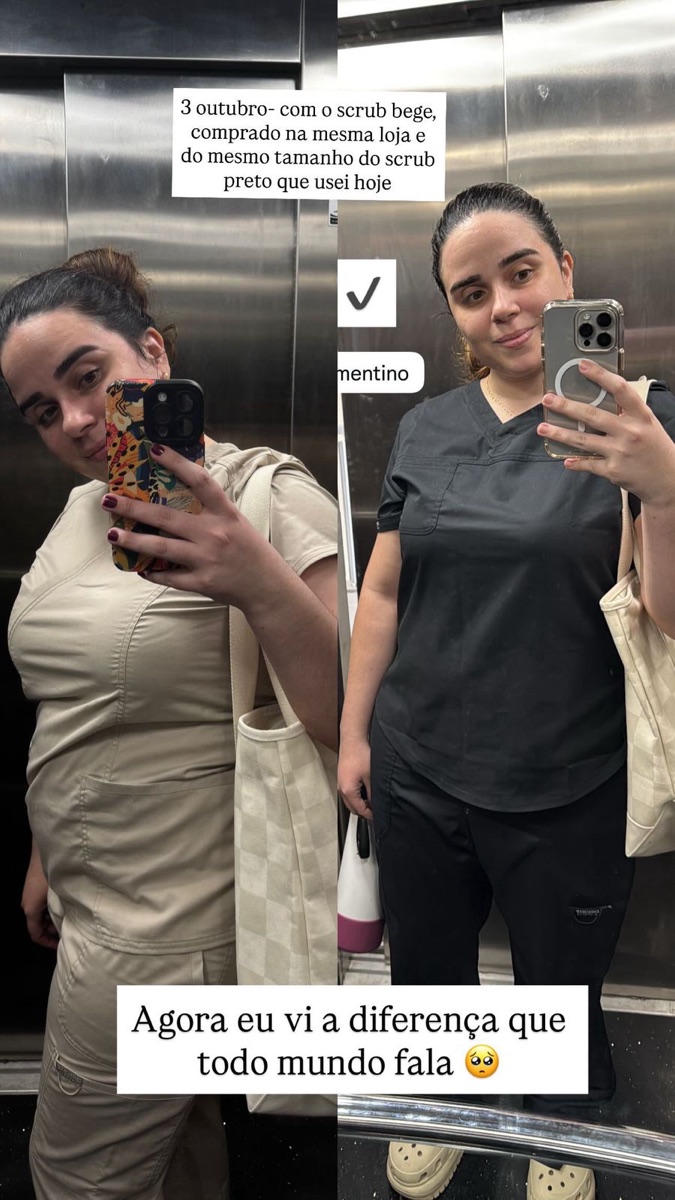 Comparativo antes e depois de paciente