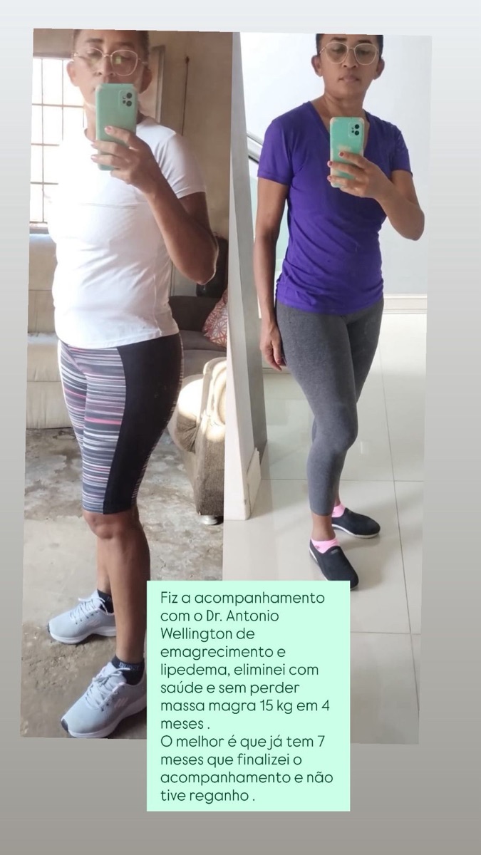 Resultado de paciente em 4 meses